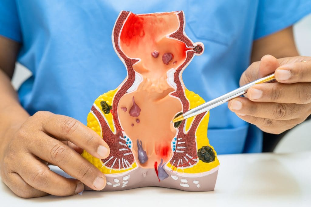 How do They do an Ablation on a Tumor? 1 ablation on a tumor