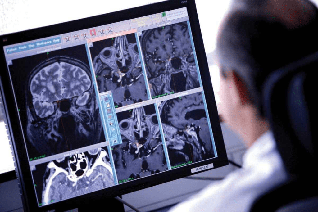 Can Brain Tumor Be Cured? Survival Facts