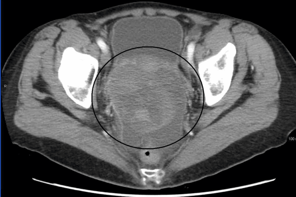 Abnormal CT Scan of Neck With Contrast: Crucial Insights