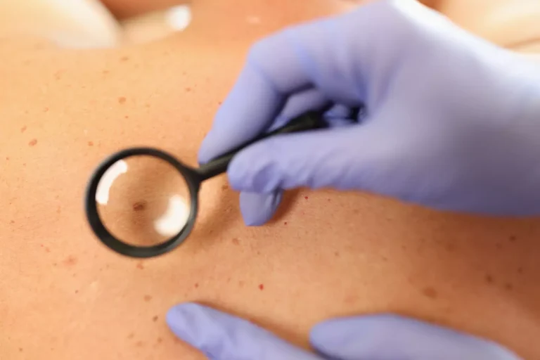 8 Effective Skin Cancer Removal Surgeries: Types, Steps & What to Expect
