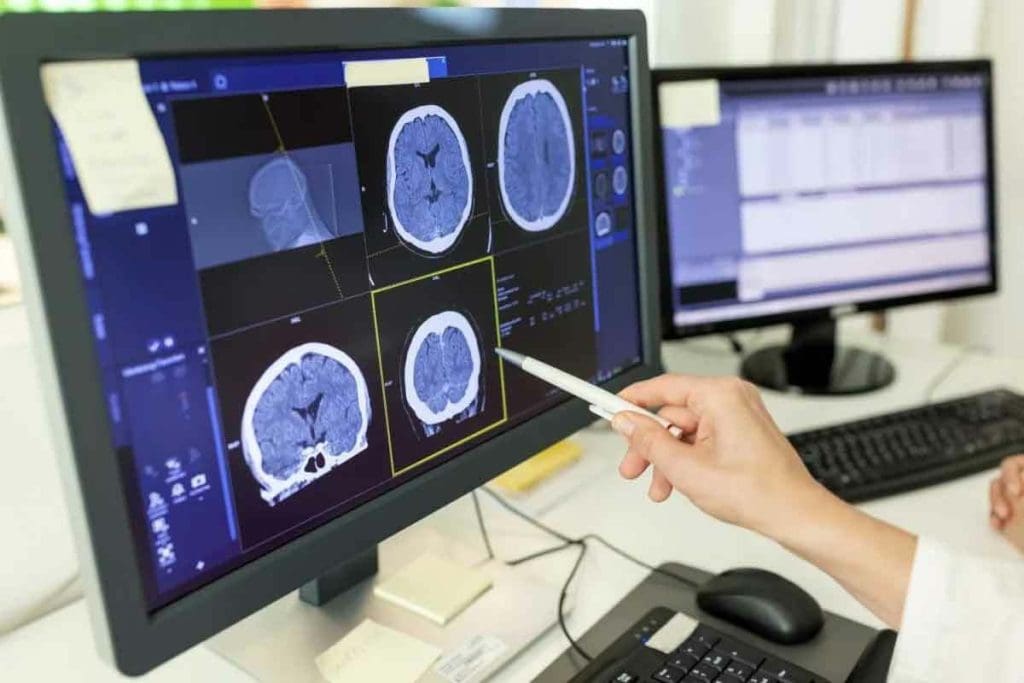 Can Brain Tumor Be Cured by Medicines?