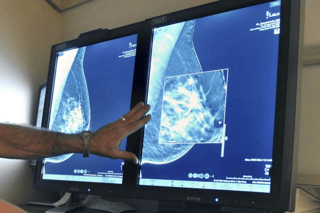 What Is the Best Scan to Detect Bone Cancer?