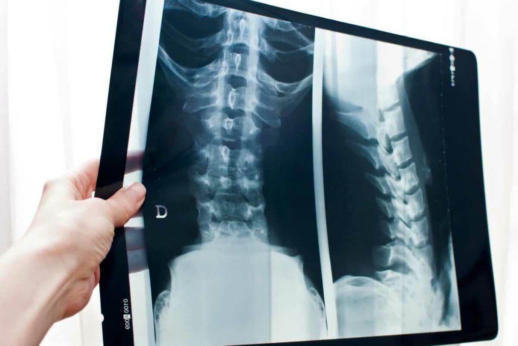 Thoracic CT Scan With Contrast: Essential Facts Revealed Now