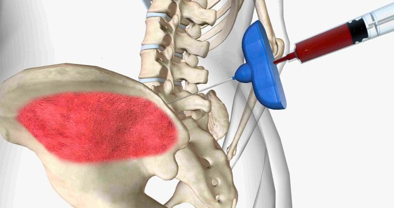 7 Essential Tips for Bone Marrow Aspiration Scar Care After Hip Biopsy