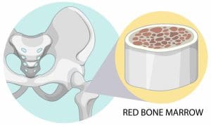 What Does a Bone Marrow Biopsy Show, and How Painful Is the Procedure?