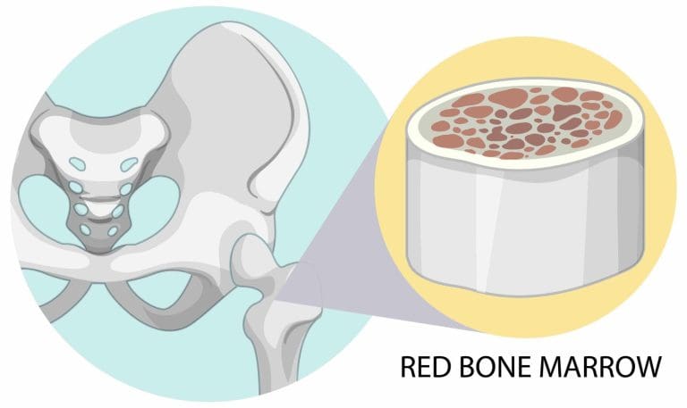What Does a Bone Marrow Biopsy Show, and How Painful Is the Procedure?