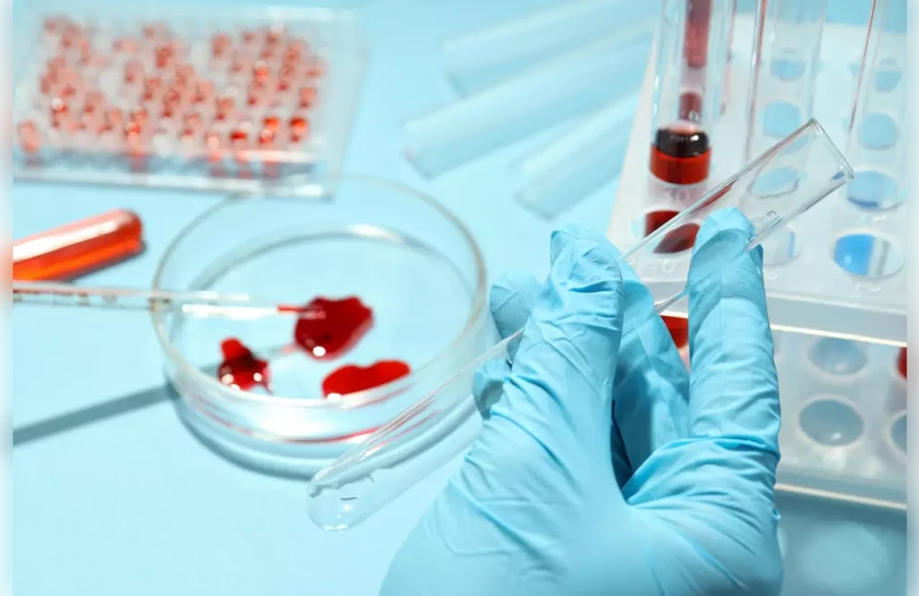 auto stem cell transplant meaning