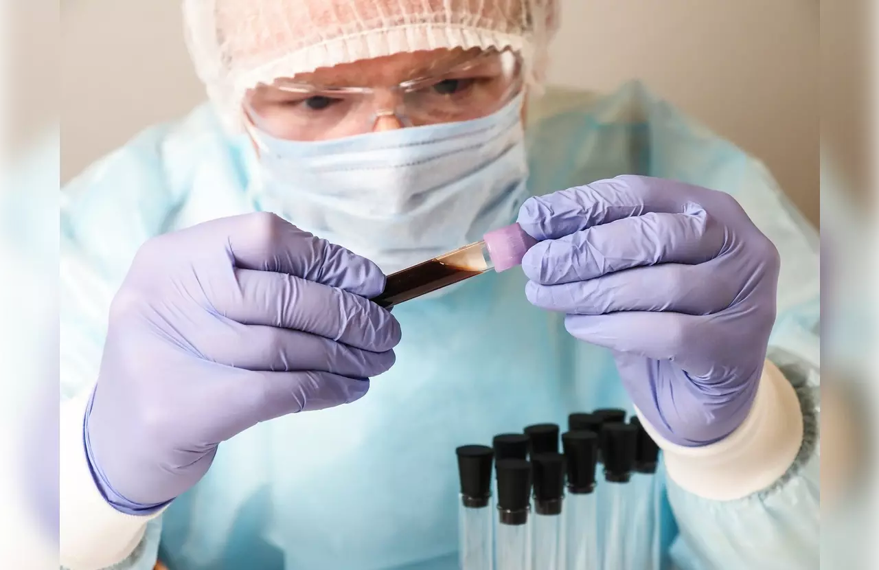 auto stem cell transplant meaning