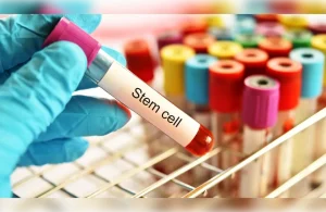 How to Undergo an Autologous Stem Cell Transplant: Step-by-Step Guide