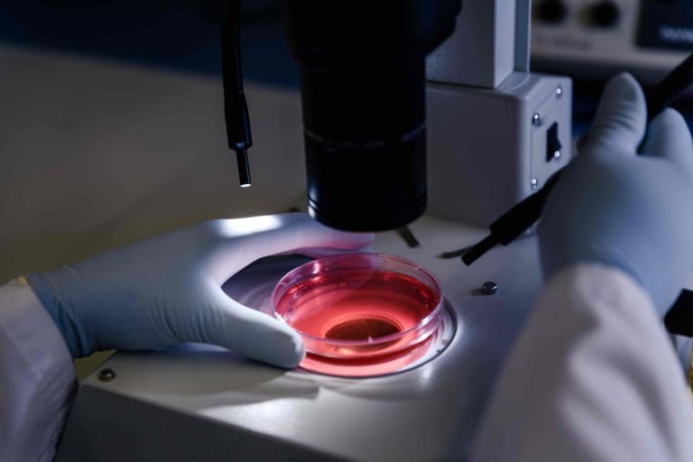 7 Key Facts About ASCT Transplant for Multiple Myeloma Patients