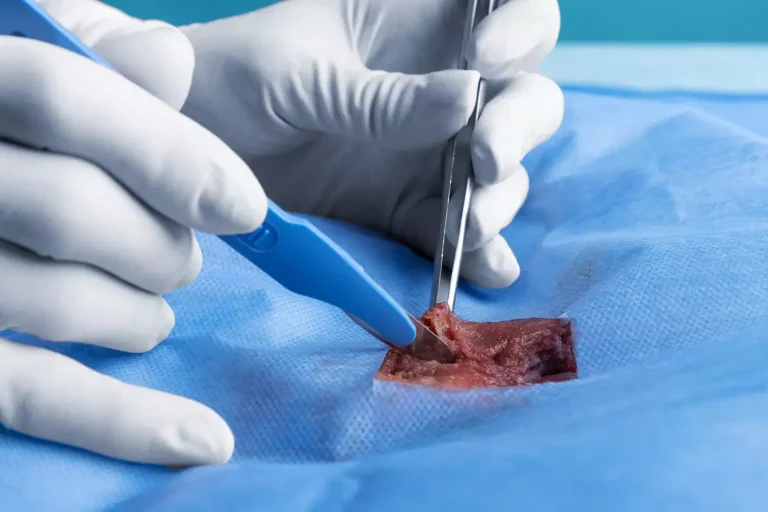 How Deep Do They Cut for Squamous Cell Carcinoma Excision?