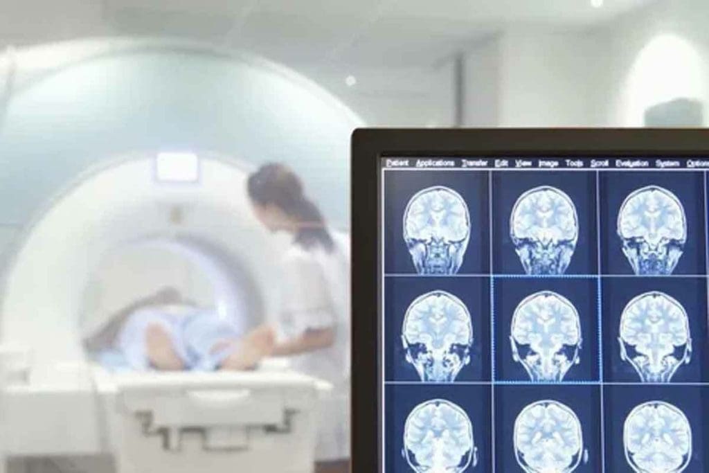 Brain Tumor MRI: 10 Key Findings 1 Brain Tumor MRI: 10 Key Findings