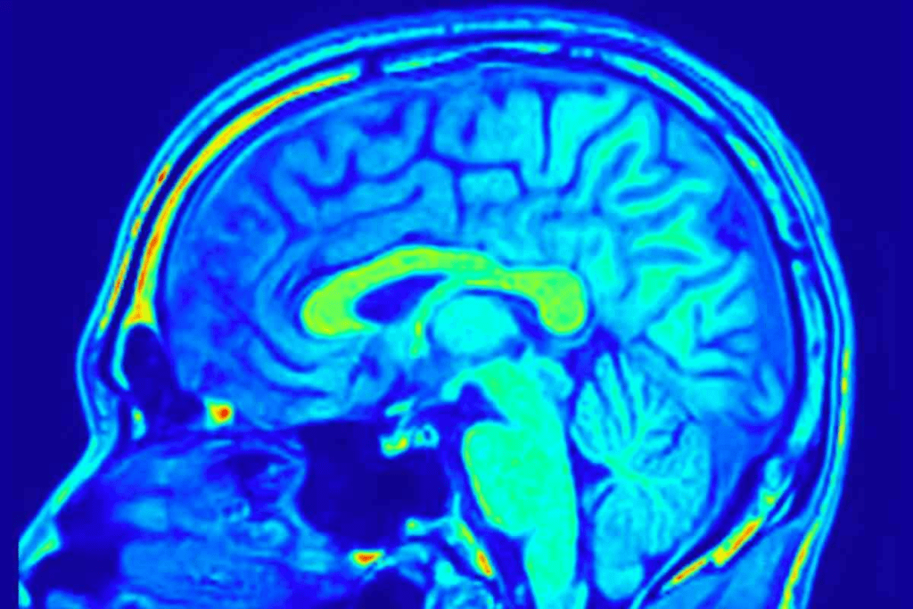 Brain Cancer MRI: 10 Key Facts