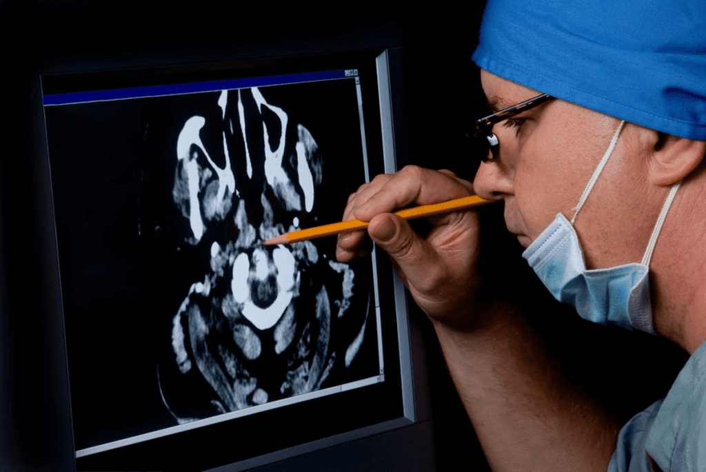 Brain Cancer CT Scan: Detection Facts