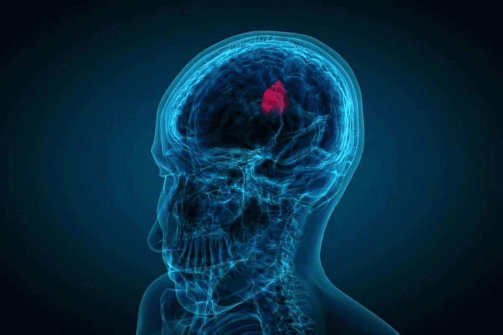 Brain Cancer Scan: Tests & Detection Accuracy