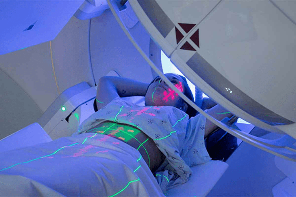 Can You Have Radiation Therapy More Than Once?