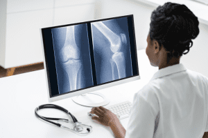Bone Scan Pictures of Cancer and Arthritis