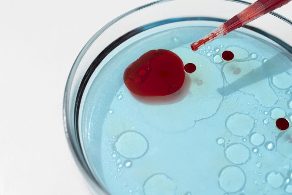 view laboratory test tube samples 3 LIV Hospital