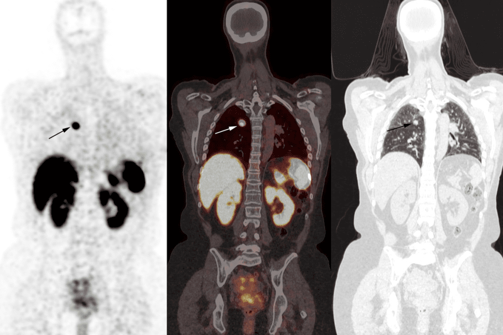 How Long Does a Bone Scan Last? 2 How Long Does a Bone Scan Last?