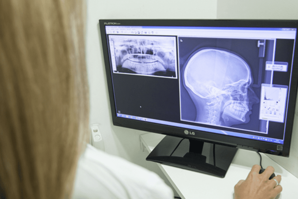 Xray and CT Scan Difference: 7 Key Facts Doctors Want You to Know