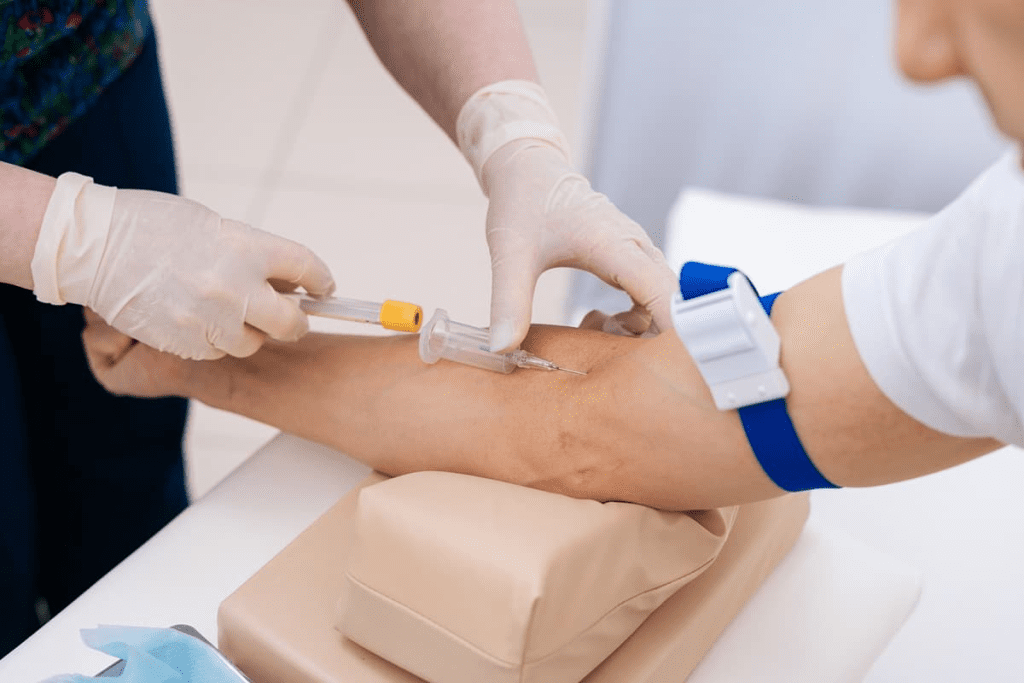 How to Diagnose Thalassemia “ Key Tests & Signs