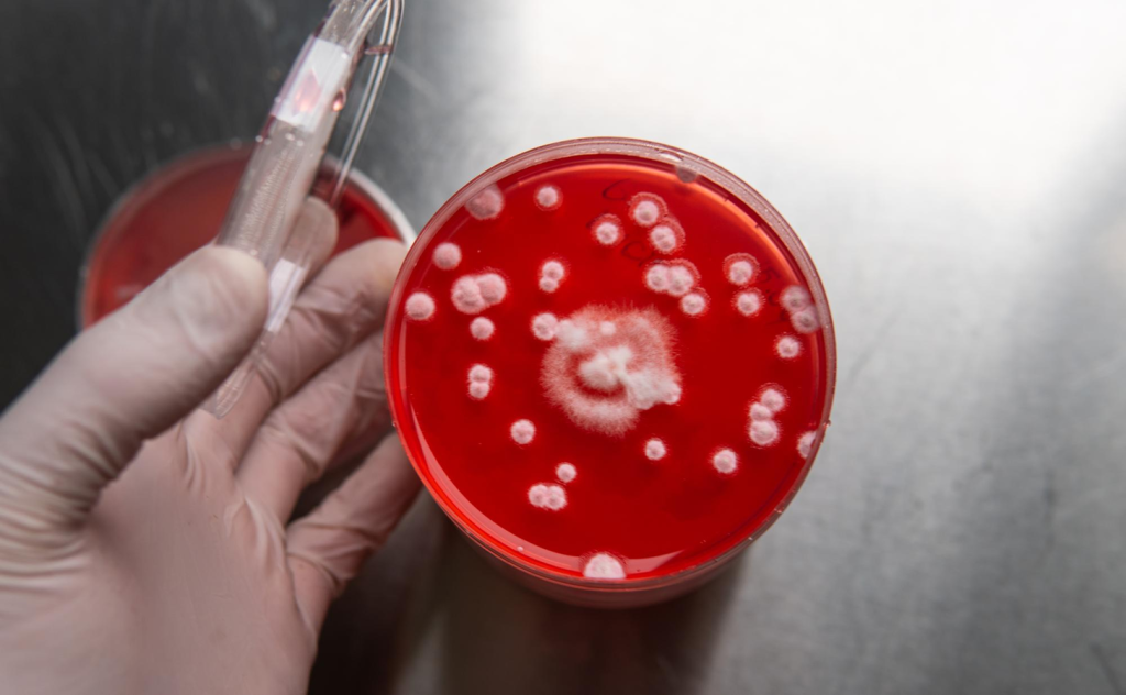 Acute Myeloid Leukemia Survival Rate Bone Marrow Transplant Statistics
