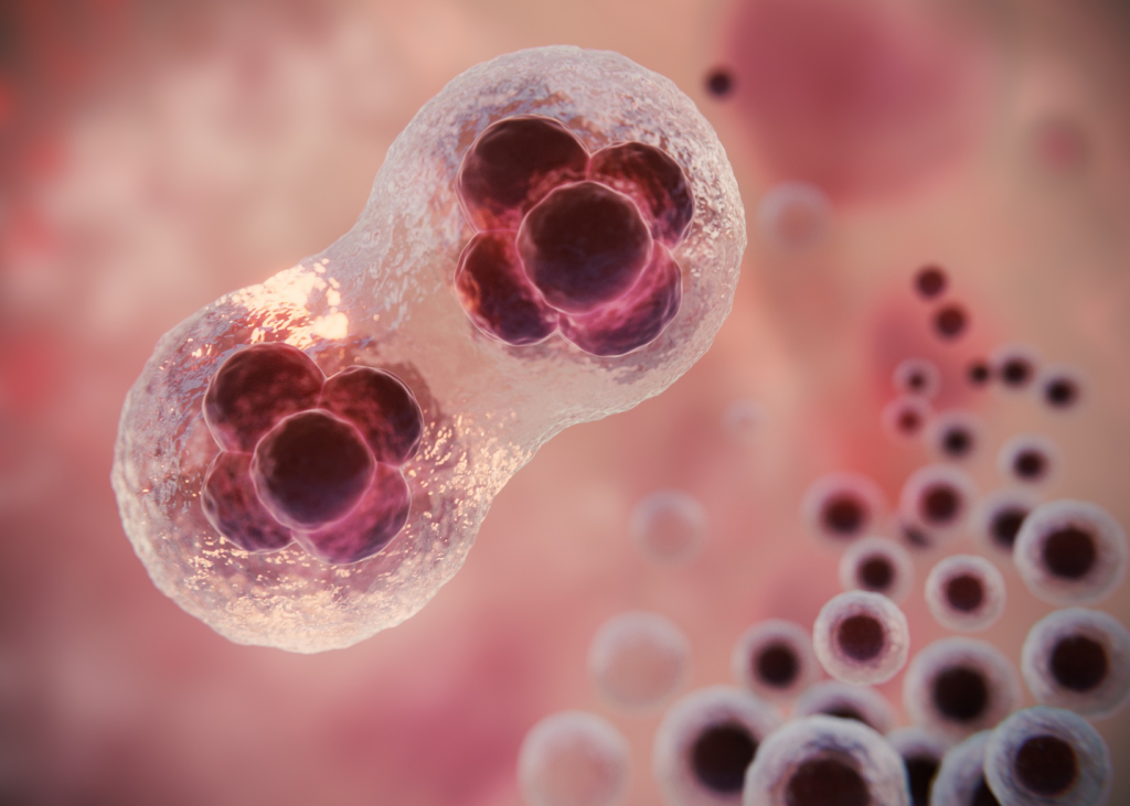 Acute Myeloid Leukemia 