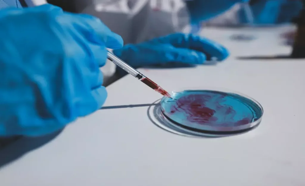 hsct stem cell transplant