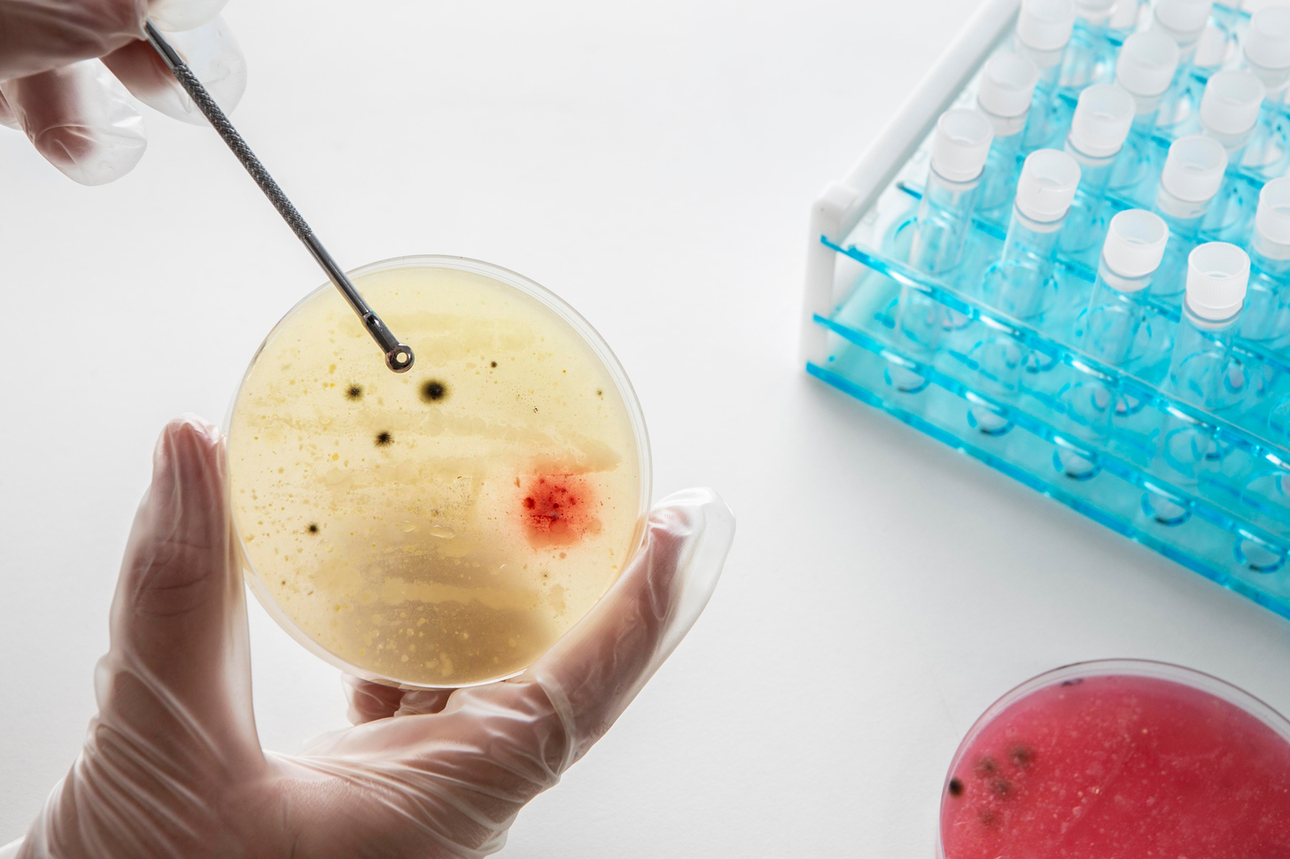 7 Key Facts About Stem Cell Treatment for Leukemia: What You Should Know