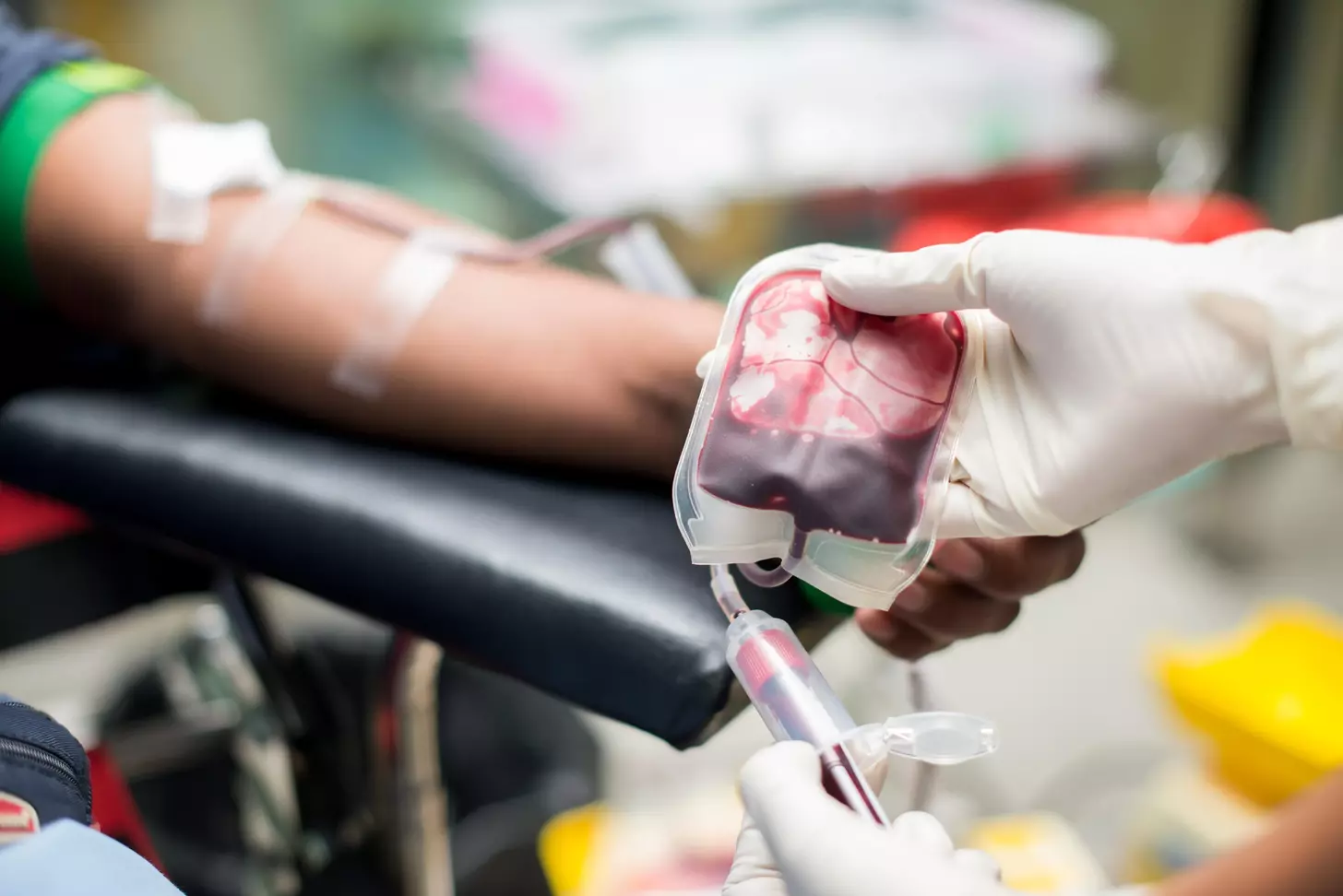 How to Undergo an Allogeneic Blood Transplant: Step-by-Step Process Explained