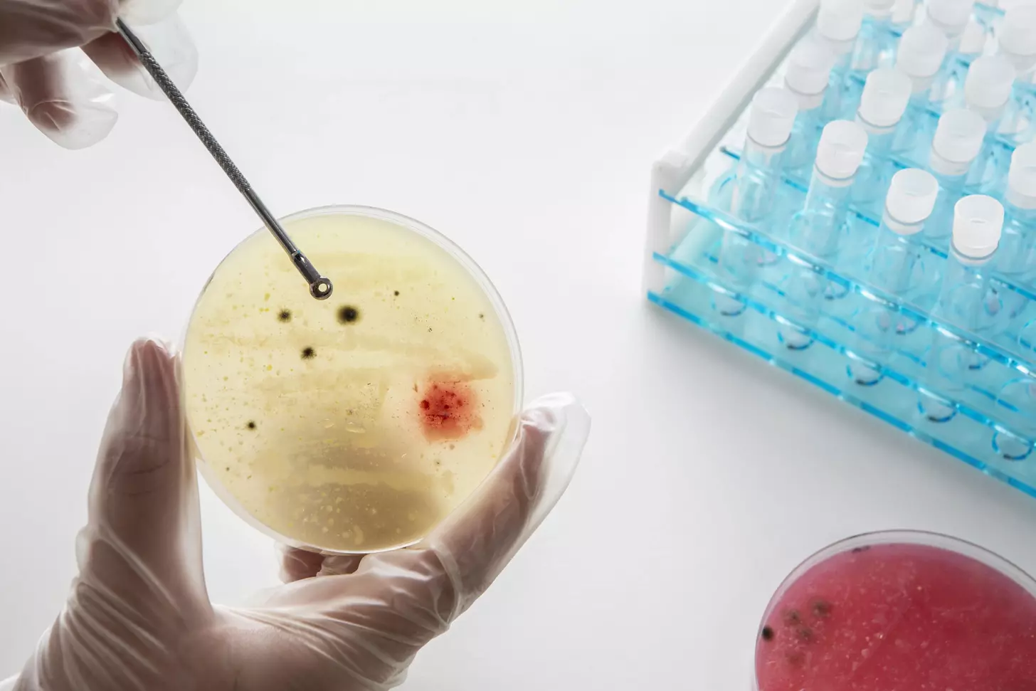 How to Understand Allogeneic Stem Cell Transplants 1 How to Understand Allogeneic Stem Cell Transplants