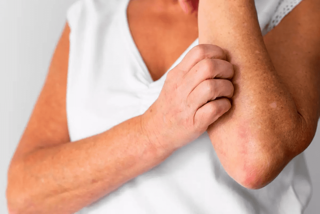 Polycythemia: 5 Crucial Negative Warning Signs