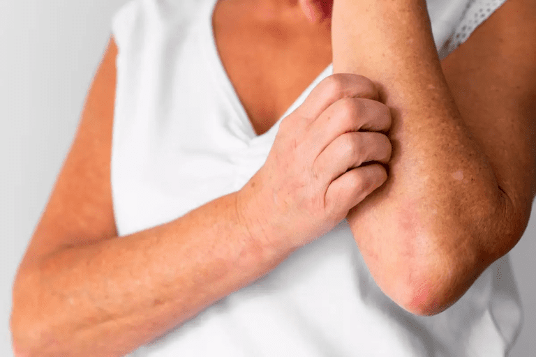 Polycythemia: 5 Crucial Negative Warning Signs