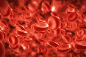 Pernicious Anemia: Crucial Guide to Negative B12