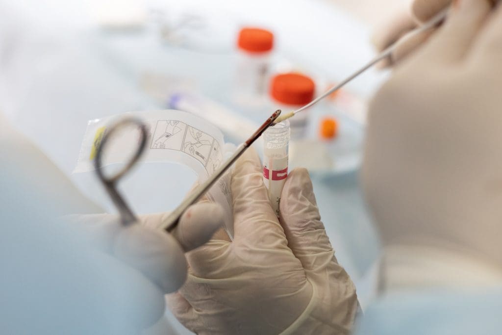 closeup doctor places piece tissue from endoscopic biopsy forceps into jar selection LIV Hospital