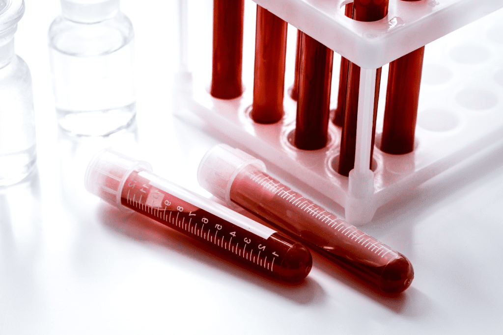 Mastocytosis: The Ultimate Guide to This Disease