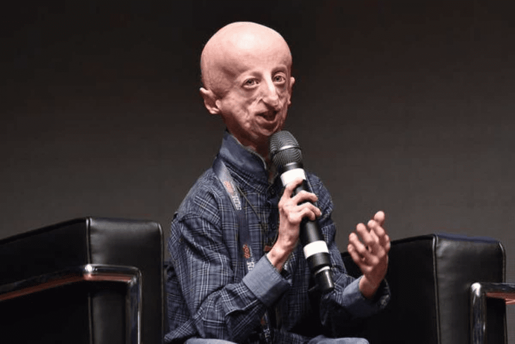 Progeria: A Critical and Devastating Disease