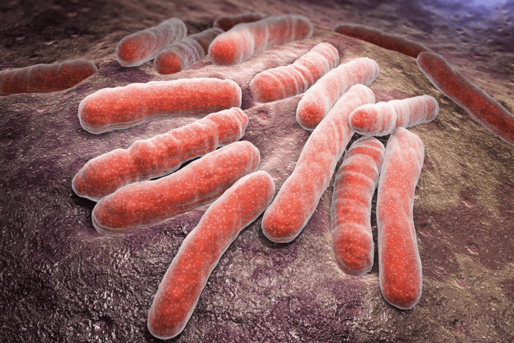 Bacteremia: The Ultimate Guide to Blood Infection 3 Bacteremia: The Ultimate Guide to Blood Infection