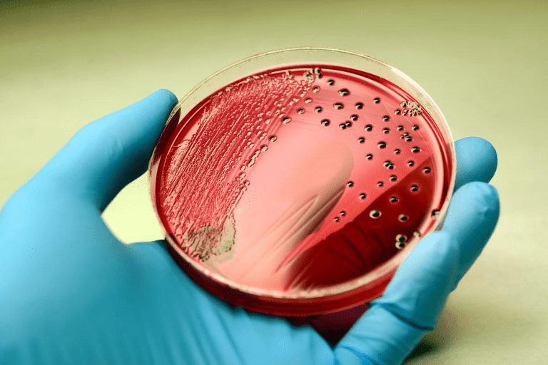 Sepsis: A Critical, Life-Threatening Emergency