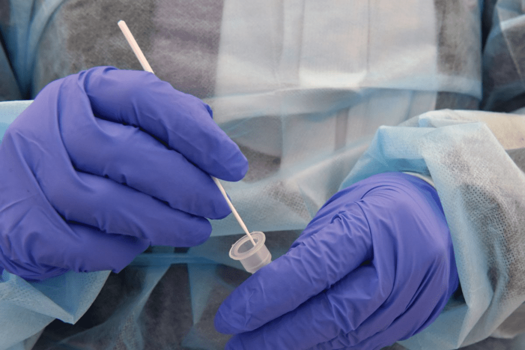 Causes of Autoimmune Diseases: Triggers