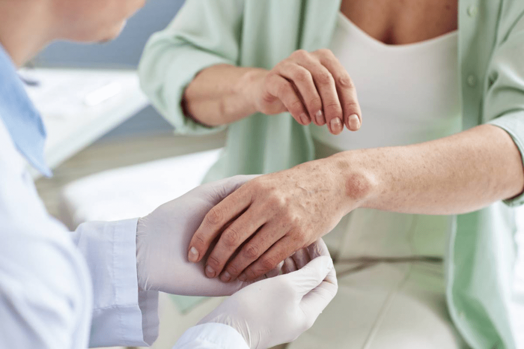 Causes of Autoimmune Diseases: Triggers