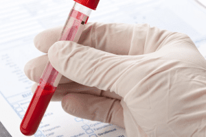 Causes of Autoimmune Diseases: Triggers