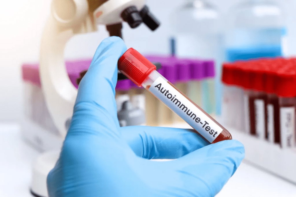 Rheumatology for Autoimmune Disorders 3 Rheumatology for Autoimmune Disorders