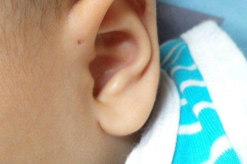 Signs of Ear Infection in Baby: Red Ear Mean Infection?