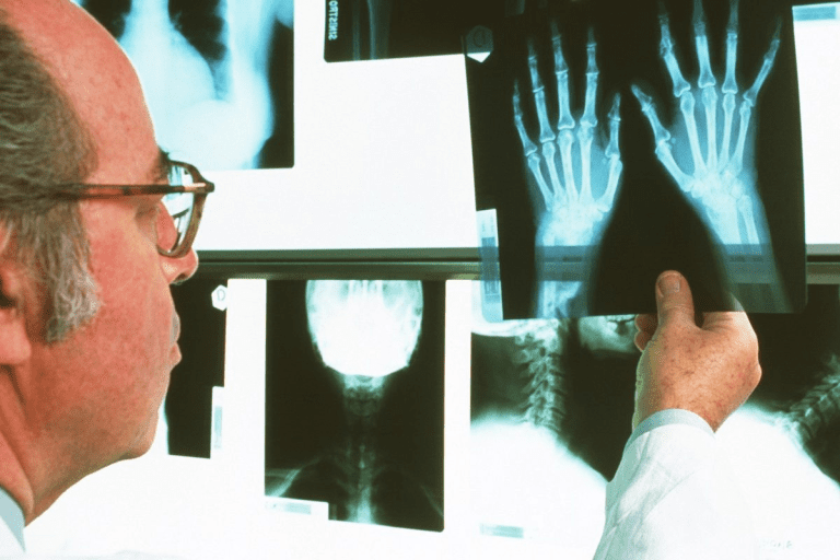 Blood Test for Autoimmune Disease: Signs & Results