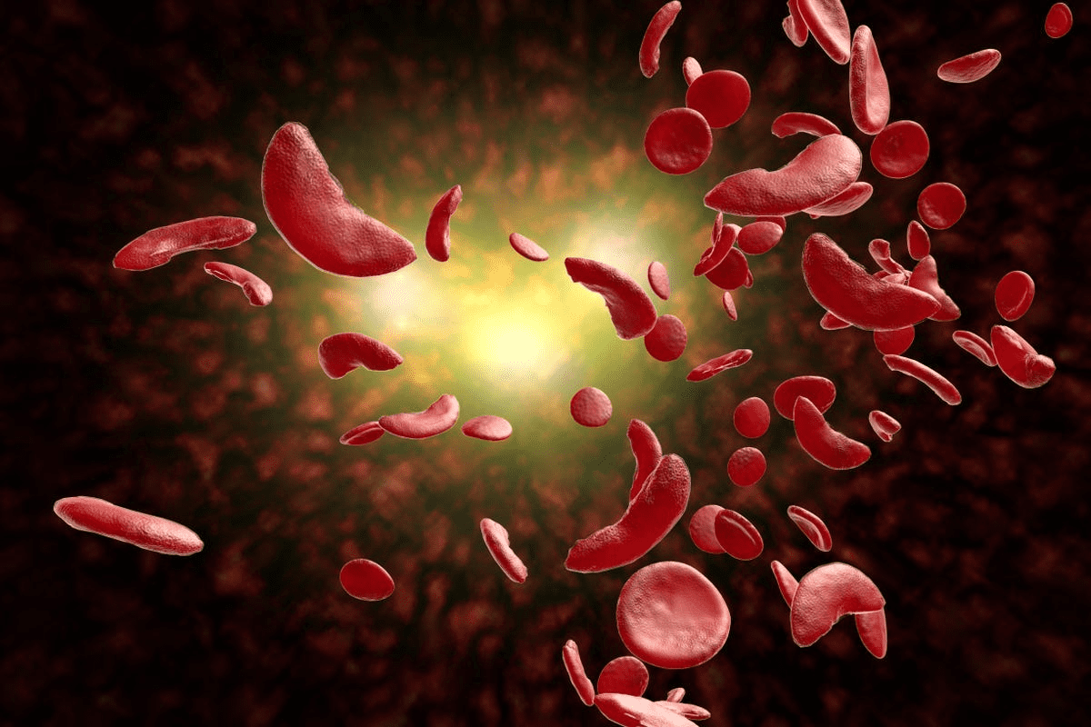 Three Most Common Blood Disorders: Shocking List