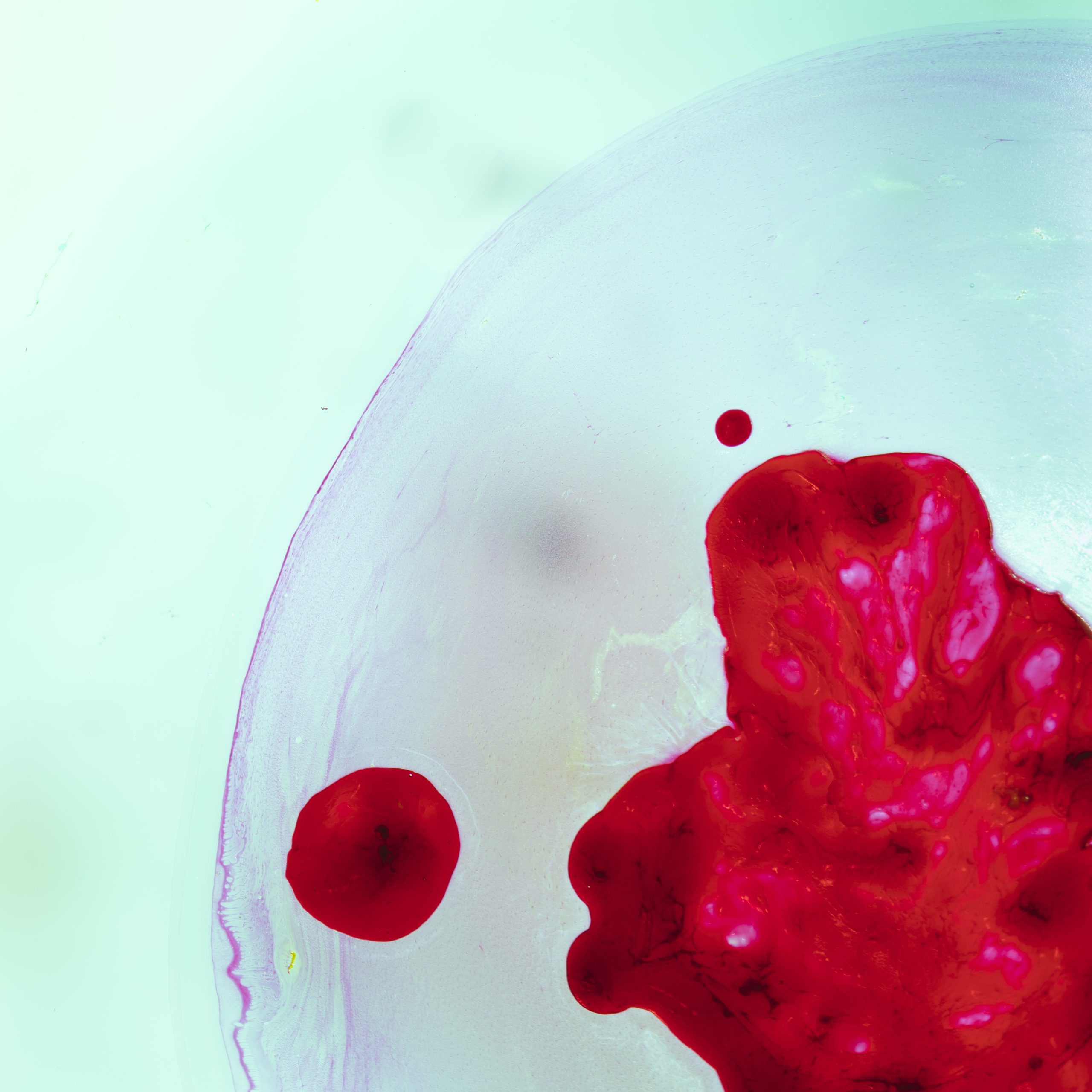 At what age is hemophilia diagnosed