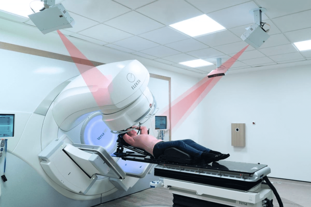 After Effects of Radiotherapy: Know the Risks 1 After Effects of Radiotherapy: Know the Risks