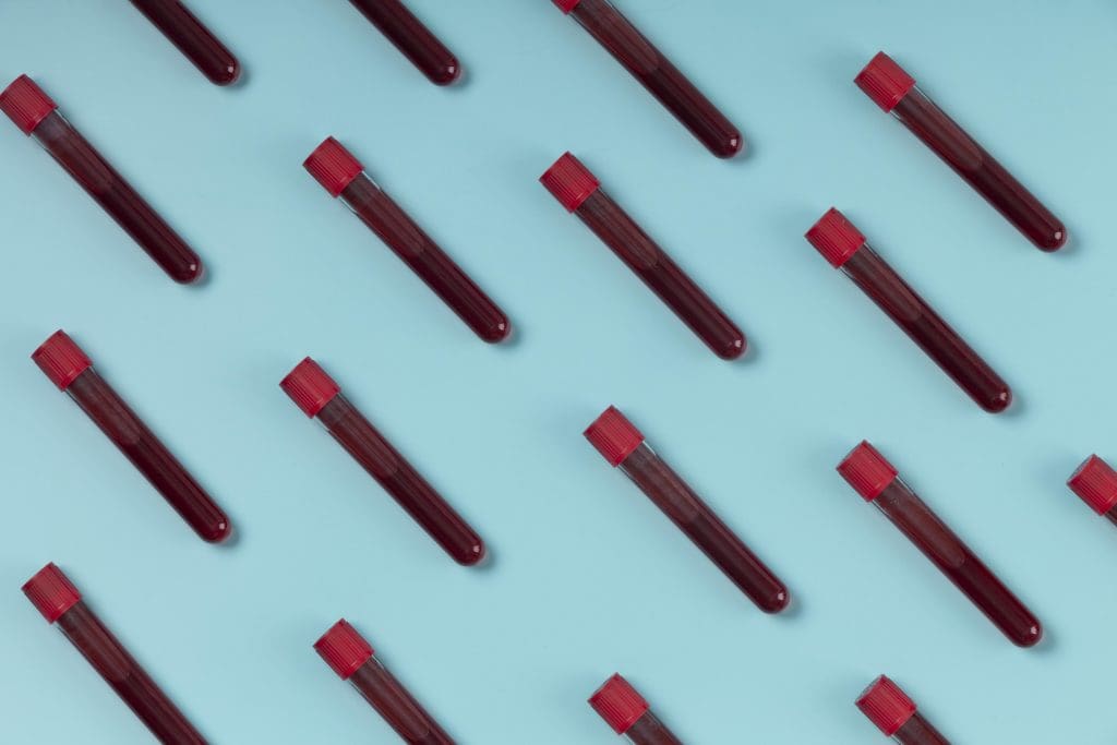 What is the Main Cause of Thalassemia