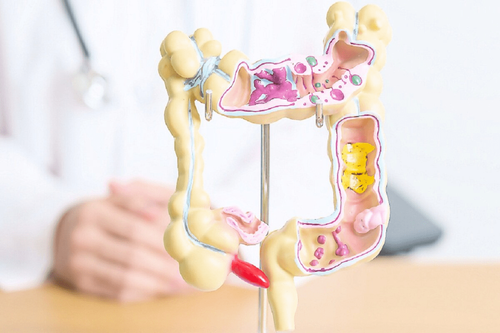 How Long Is the Colon? Fast-Spread Cancer Facts